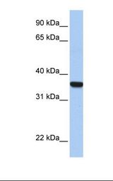 Fetal liver lysate. Antibody concentration: 1.0 ug/ml. Gel concentration: 12%.