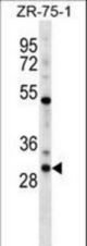 HOXD1 Antibody western blot of ZR-75-1 cell line lysates (35 ug/lane). The HOXD1 antibody detected the HOXD1 protein (arrow).