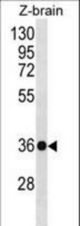 HOXD10 Antibody western blot of zebra fish brain tissue lysates (35 ug/lane). The HOXD10 antibody detected the HOXD10 protein (arrow).