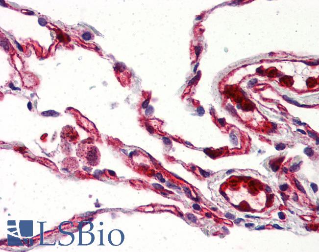 Anti-GPR132 / G2A antibody LS-A1604 IHC of human lung. Immunohistochemistry of formalin-fixed, paraffin-embedded tissue after heat-induced antigen retrieval.