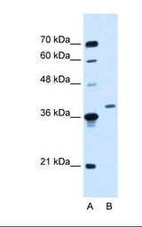 HepG2 cell lysate. Antibody concentration: 0.25 ug/ml. Gel concentration: 12%.