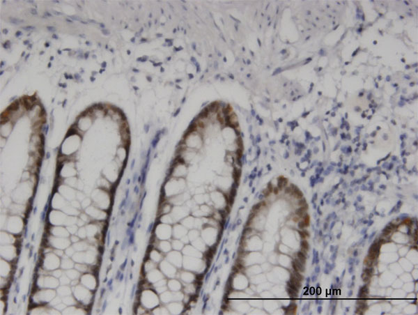 Immunoperoxidase of monoclonal antibody to HOXD11 on formalin-fixed paraffin-embedded human colon. [antibody concentration 0.7 ug/ml]