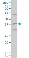 HOXD11 monoclonal antibody (M10), clone 6C8 Western blot of HOXD11 expression in K-562.
