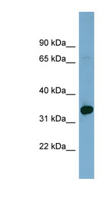 HOXD12 antibody LS-C112144 Western blot of COLO205 cell lysate.