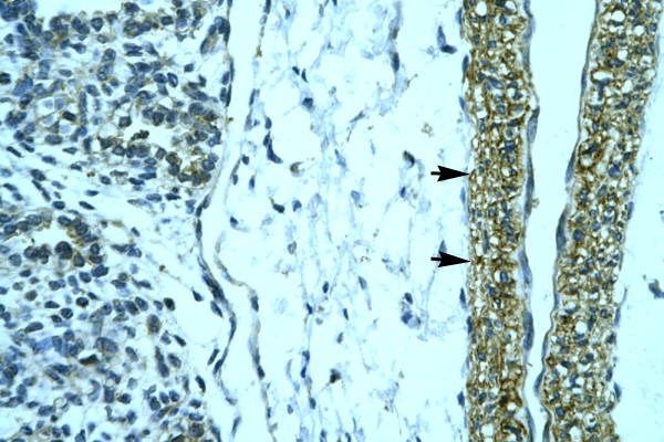 HOXD12 antibody LS-C30686 IHC of formalin-fixed, paraffin-embedded human Smooth Muscle. Positive label: Vascular smooth muscle cells indicated with arrows. Antibody concentration 4-8 ug/ml. Magnification 400X.