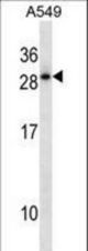 HOXD12 Antibody western blot of A549 cell line lysates (35 ug/lane). The HOXD12 antibody detected the HOXD12 protein (arrow).