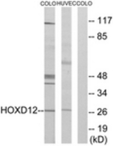 Western blot of extracts from COLO205/HucEc cells, treated with serum 20% 15', using HOXD12 Antibody. The lane on the right is treated with the synthesized peptide.