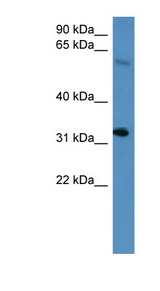HOXD13 antibody LS-C134937 Western blot of Mouse Spleen lysate.