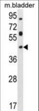 HOXD13 Antibody western blot of mouse bladder tissue lysates (35 ug/lane). The HOXD13 antibody detected the HOXD13 protein (arrow).