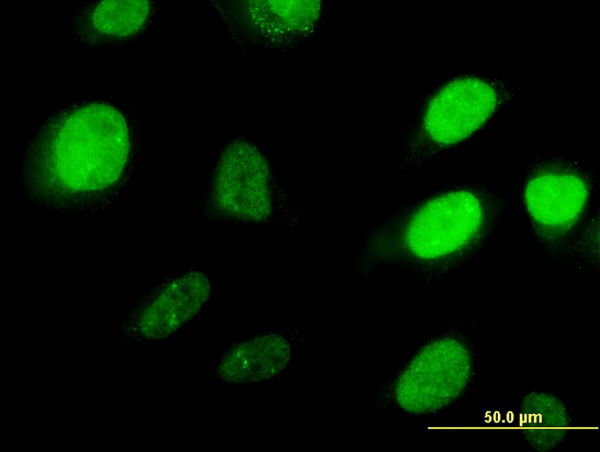 Immunofluorescence of monoclonal antibody to HOXD3 on HeLa cell . [antibody concentration 10 ug/ml]