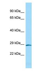 HOXD4 antibody Western Blot of Rat Pancreas.