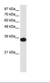 Transfected 293T Cell Lysate