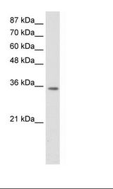 Transfected 293T Cell Lysate