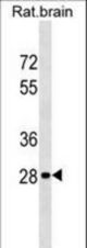 Rat Hoxd9 Antibody western blot of rat brain tissue lysates (35 ug/lane). The Hoxd9 antibody detected the Hoxd9 protein (arrow).