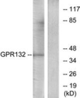 Western blot of extracts from Jurkat cells, using GPR132 Antibody. The lane on the right is treated with the synthesized peptide.