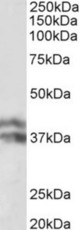 HP antibody (0.1 ug/ml) staining of Human Liver lysate (35 ug protein in RIPA buffer). Primary incubation was 1 hour. Detected by chemiluminescence.