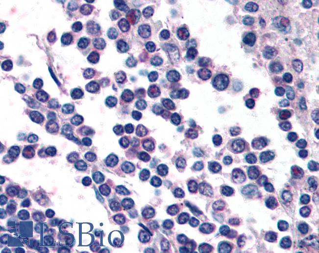 Anti-GPR132 / G2A antibody LS-A3701 IHC of human spleen. Immunohistochemistry of formalin-fixed, paraffin-embedded tissue after heat-induced antigen retrieval.
