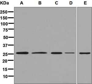 Western blot analysis on (A) Y79, (B) SH-SY5Y, (C) C6, (D) Neuro-2a, and (E) U87-MG cell lysates using anti-Hippocalcin antibody.