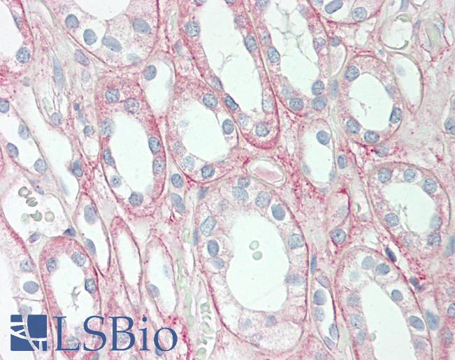 Human Kidney: Formalin-Fixed, Paraffin-Embedded (FFPE)