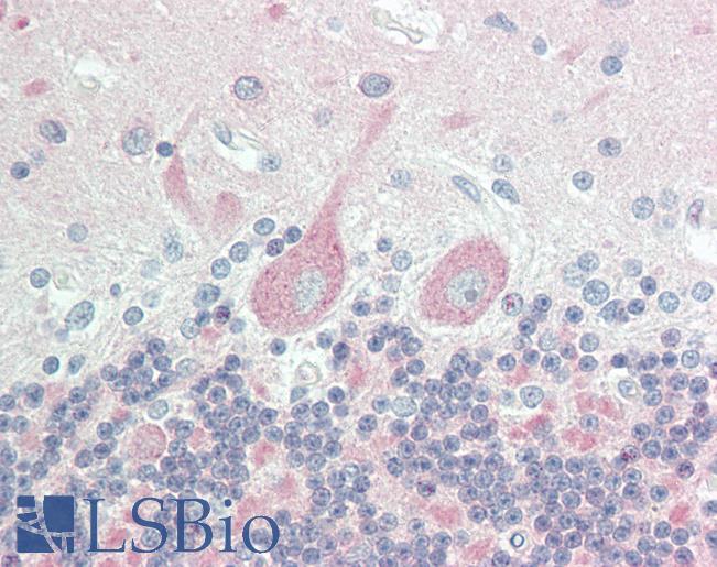 Human Brain, Cerebellum: Formalin-Fixed, Paraffin-Embedded (FFPE)
