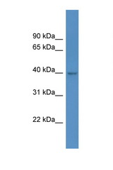 HPDL antibody LS-C135848 Western blot of 293T Cell lysate. Antibody concentration 1 ug/ml.