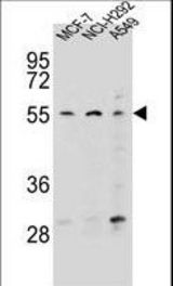 ZNF117 Antibody western blot of MCF-7,NCI-H292,A549 cell line lysates (35 ug/lane). The ZNF117 antibody detected the ZNF117 protein (arrow).