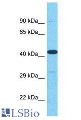 HPH2 / PHC2 antibody Western Blot of HT1080. Antibody dilution: 1 ug/ml.
