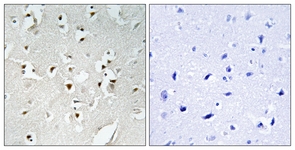 IHC of paraffin-embedded human brain, using PMS1 Antibody. The picture on the right is treated with the synthesized peptide.