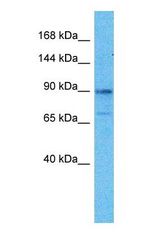 Western blot of PMS1 Antibody with human 293T Whole Cell lysate.