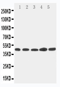 WB of HPN / TMPRSS1 / Hepsin antibody. Lane 1: 293T Cell Lysate. Lane 2: NRK Cell Lysate. Lane 3: HELA Cell Lysate. Lane 4: PANC Cell Lysate. Lane 5: MFC-7 Cell Lysate..