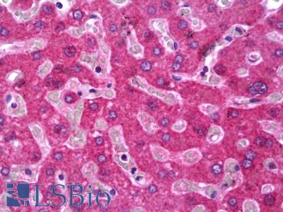 Anti-HPN / Hepsin antibody IHC of human liver. Immunohistochemistry of formalin-fixed, paraffin-embedded tissue after heat-induced antigen retrieval. Antibody LS-B6933 concentration 5 ug/ml.
