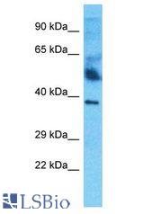 HPR antibody Western Blot of Thymus Tumor. Antibody dilution: 1 ug/ml.