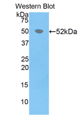 Western blot of recombinant HPRT1 / HPRT.