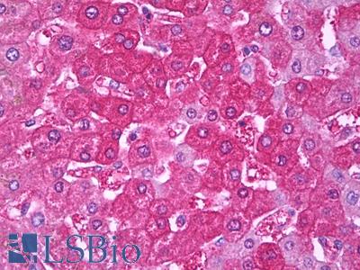 Anti-HPRT1 antibody IHC of human liver. Immunohistochemistry of formalin-fixed, paraffin-embedded tissue after heat-induced antigen retrieval. Antibody LS-B7273 dilution 1:50.