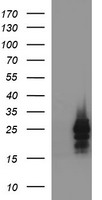 HEK293T cells were transfected with the pCMV6-ENTRY control (Left lane) or pCMV6-ENTRY HPRT1 (Right lane) cDNA for 48 hrs and lysed. Equivalent amounts of cell lysates (5 ug per lane) were separated by SDS-PAGE and immunoblotted with anti-HPRT1.