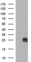 HEK293T cells were transfected with the pCMV6-ENTRY control (Left lane) or pCMV6-ENTRY HPRT1 (Right lane) cDNA for 48 hrs and lysed. Equivalent amounts of cell lysates (5 ug per lane) were separated by SDS-PAGE and immunoblotted with anti-HPRT1.