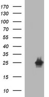 HEK293T cells were transfected with the pCMV6-ENTRY control (Left lane) or pCMV6-ENTRY HPRT1 (Right lane) cDNA for 48 hrs and lysed. Equivalent amounts of cell lysates (5 ug per lane) were separated by SDS-PAGE and immunoblotted with anti-HPRT1.