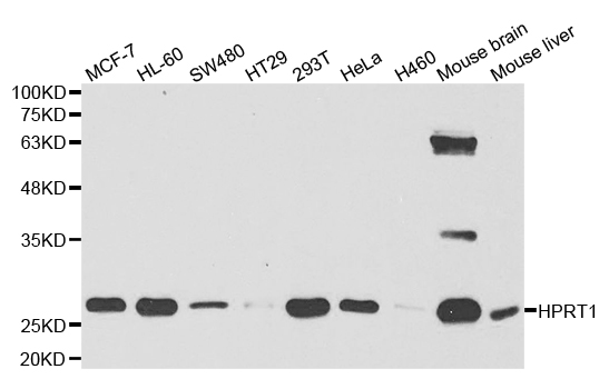 Western blot analysis of extracts of various cell lines, using HPRT1 antibody.