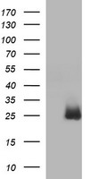 HEK293T cells were transfected with the pCMV6-ENTRY control (Left lane) or pCMV6-ENTRY HPRT1 (Right lane) cDNA for 48 hrs and lysed. Equivalent amounts of cell lysates (5 ug per lane) were separated by SDS-PAGE and immunoblotted with anti-HPRT1.