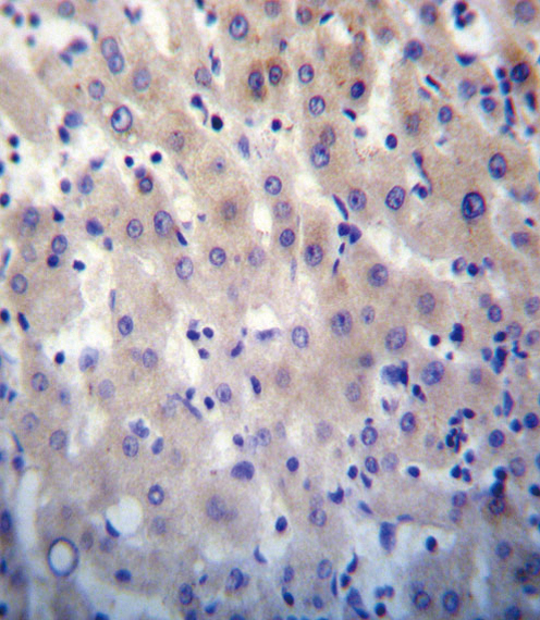 HPRT1 Antibody immunohistochemistry of formalin-fixed and paraffin-embedded human liver tissue followed by peroxidase-conjugated secondary antibody and DAB staining.