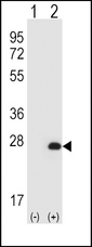Western blot of HPRT1 (arrow) using rabbit polyclonal HPRT1 Antibody. 293 cell lysates (2 ug/lane) either nontransfected (Lane 1) or transiently transfected (Lane 2) with the HPRT1 gene.