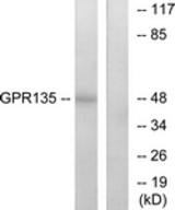Western blot of extracts from NIH-3T3 cells, using GPR135 Antibody. The lane on the right is treated with the synthesized peptide.