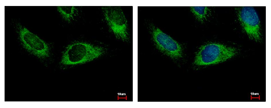 HPS3 antibody [C3], C-term detects HPS3 protein at cytoplasm by immunofluorescent analysis. HeLa cells were fixed in 4% paraformaldehyde at RT for 15 min. HPS3 protein stained by HPS3 antibody [C3], C-term diluted at 1:500. 