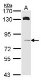 Sample (30 ug of whole cell lysate). A: A431 . 7.5% SDS PAGE. HPS6 antibody diluted at 1:1000.