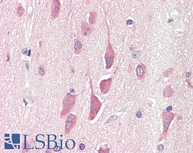 Anti-HPS6 antibody IHC staining of human brain, cortex. Immunohistochemistry of formalin-fixed, paraffin-embedded tissue after heat-induced antigen retrieval. Antibody LS-B10281 concentration 5 ug/ml.