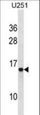 HPSE Antibody western blot of U251 cell line lysates (35 ug/lane). The HPSE antibody detected the HPSE protein (arrow).