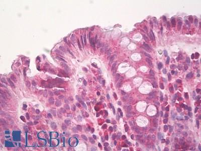 Anti-HPSE / Heparanase antibody IHC of human colon, epithelium. Immunohistochemistry of formalin-fixed, paraffin-embedded tissue after heat-induced antigen retrieval. Antibody LS-B8258 dilution 5-10 ug/mg lysate.