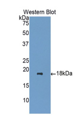 Western blot of recombinant HPSE / Heparanase.