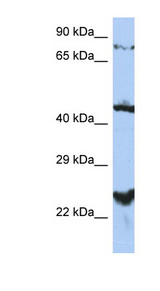 MRS2 / MRS2L antibody LS-C111236 Western blot of PANC1 cell lysate.