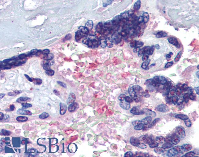Anti-Hemopexin antibody IHC of human placenta, serum. Immunohistochemistry of formalin-fixed, paraffin-embedded tissue after heat-induced antigen retrieval. Antibody LS-B3811 concentration 3.75 ug/ml.